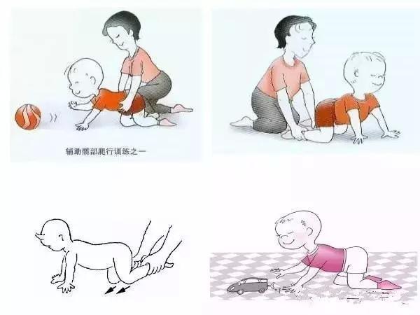 孩子脑瘫会出现哪些症状